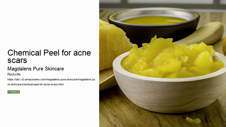 Chemical Peel for acne scars